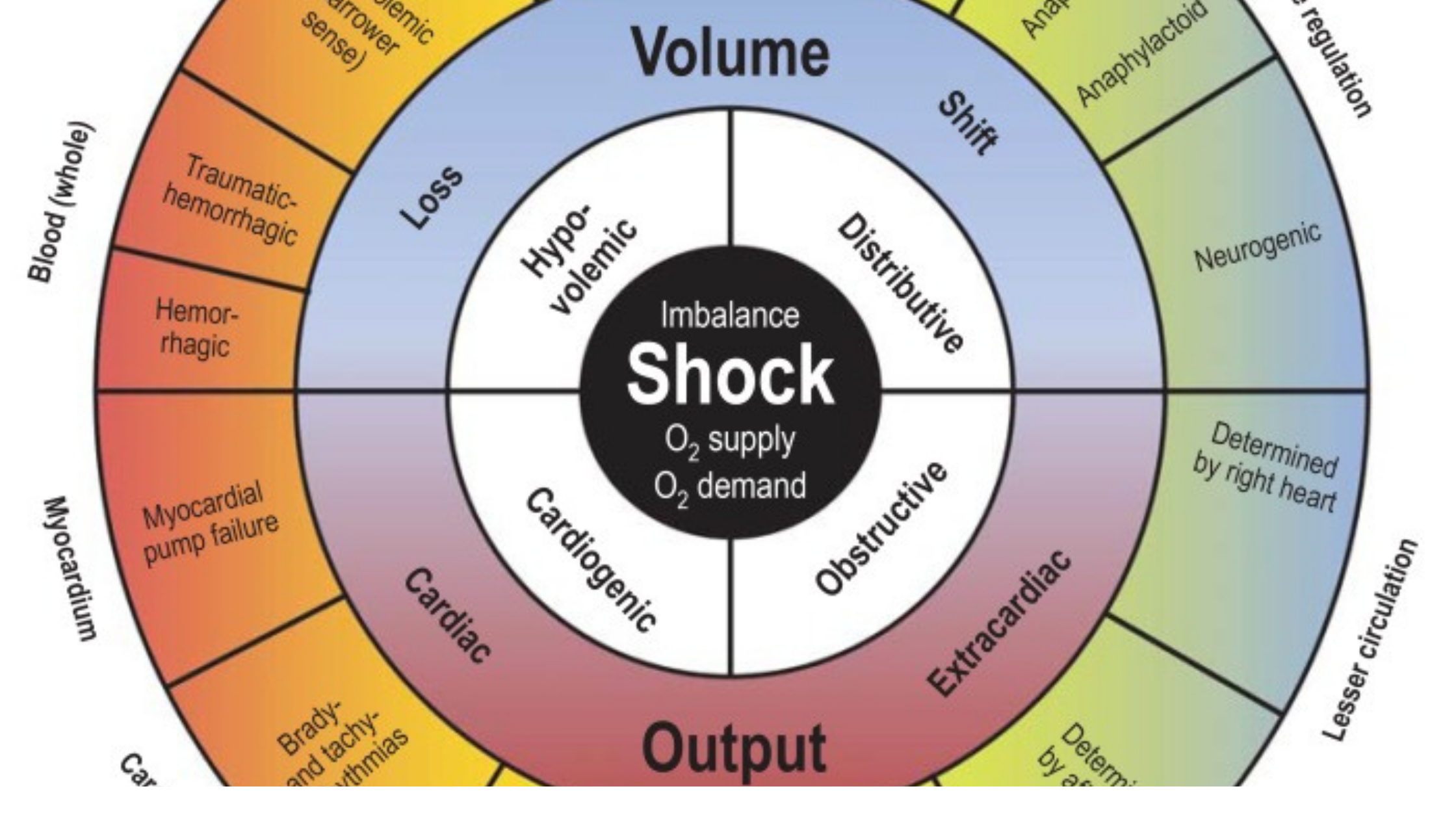 Different types of shock